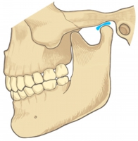 3つのことが実際にお口の中でも起こっている可能性がある